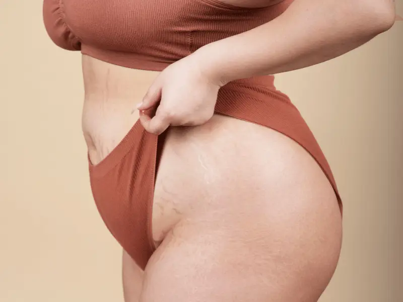 胃球囊火鸡:蜕变前8个令人安心的见解 Gastric Balloon Turkey – patient results at Vivid Clinic Istanbul
