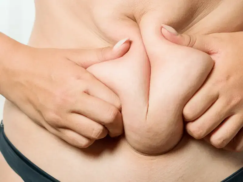 胃球囊火鸡:蜕变前8个令人安心的见解 Personalized consultation for gastric mini bypass