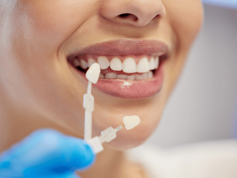 Tandkronen in Turkije: 9 betrouwbare tips vóór uw transformatie Patient before and after zirconium crowns: a side by side comparison showing a patient’s teeth before and afte