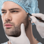 Man considering benefits of Beard Transplant