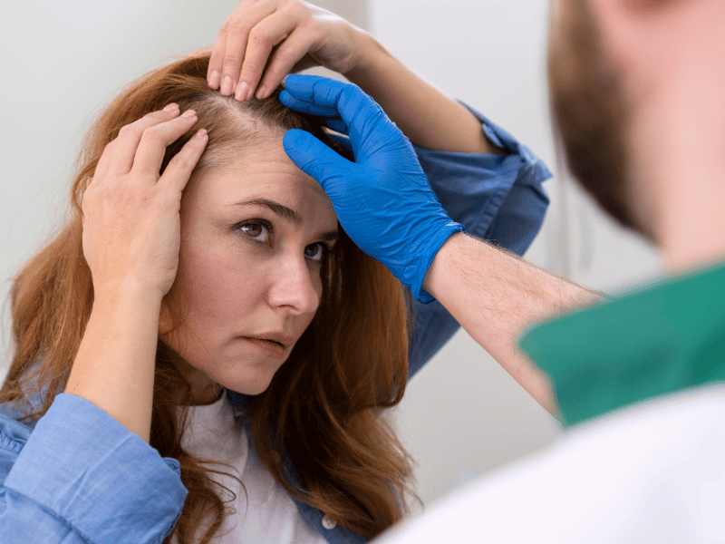 Trasplante capilar para mujeres: 10 consejos tranquilizadores antes de tu transformación. Women Hair Transplant – patient results at Vivid Clinic Istanbul