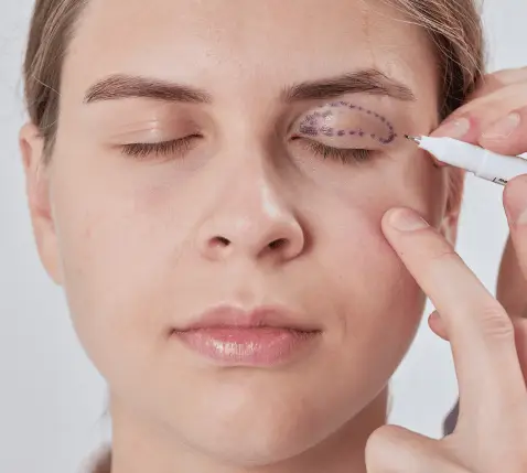 Eyelid Lift Consultation