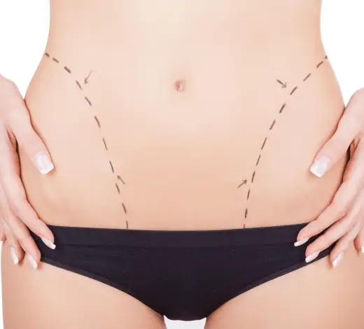 Patient Researching Abdominoplasty Procedure