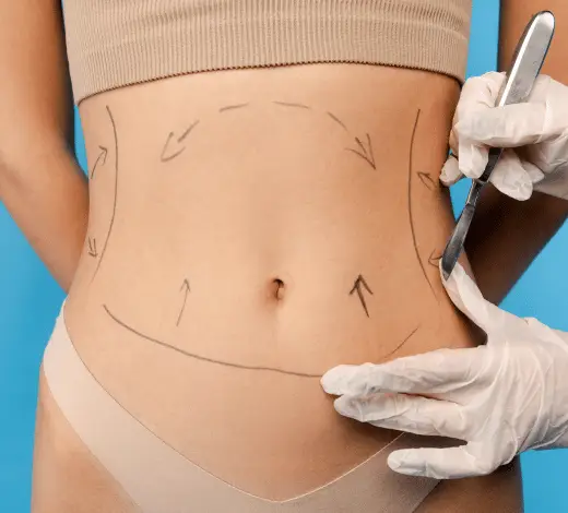 Patient Researching Liposuction Options