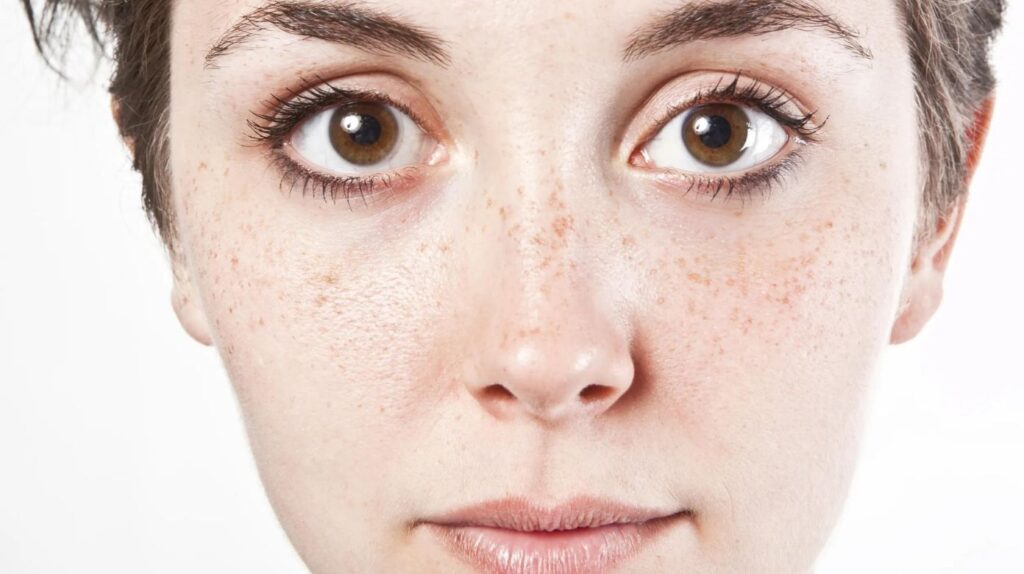 Woman with a straight, symmetrical nose bridge, showcasing classical beauty.