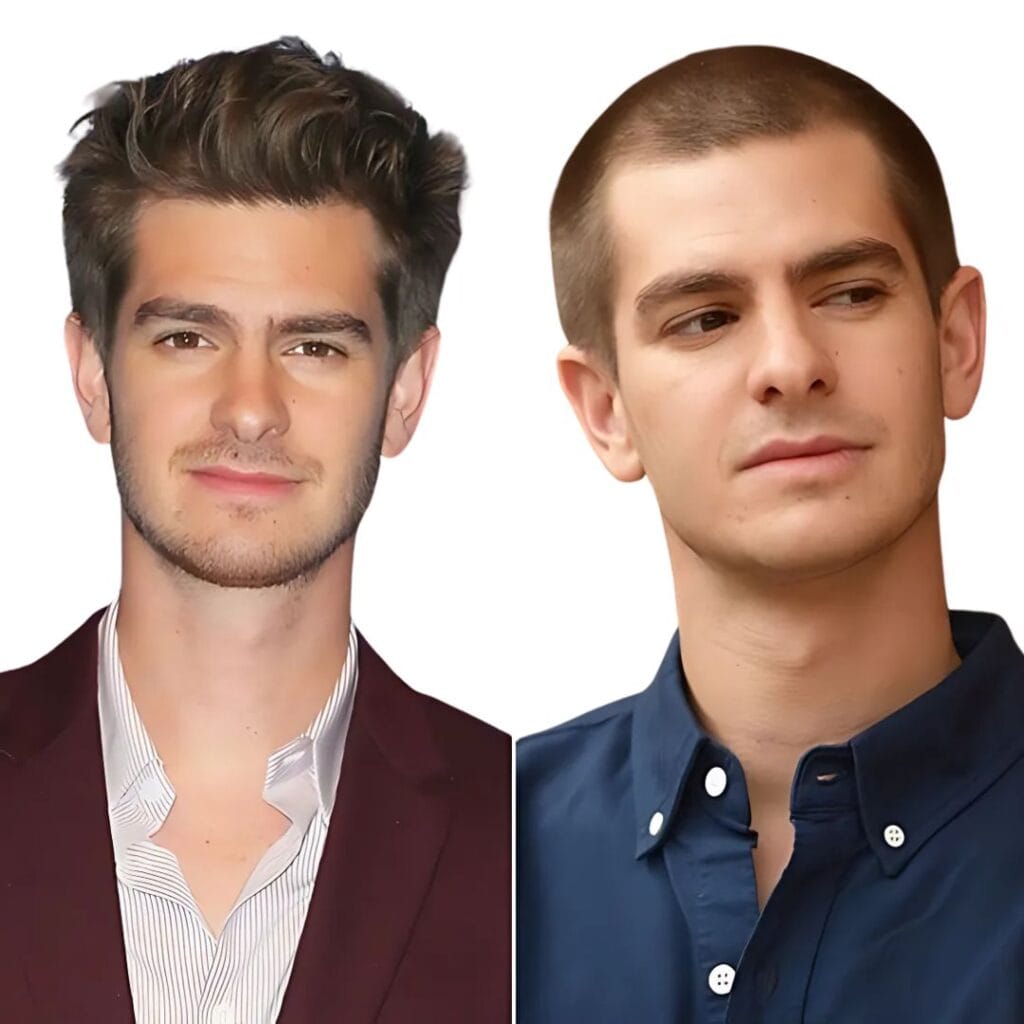 Andrew Garfield hairtransplant
Open Celebrity Hair Transplant Journeys - Inspiring Transformations