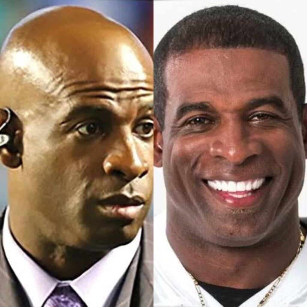 How did Deion Sanders address his hair loss and transplant experience?