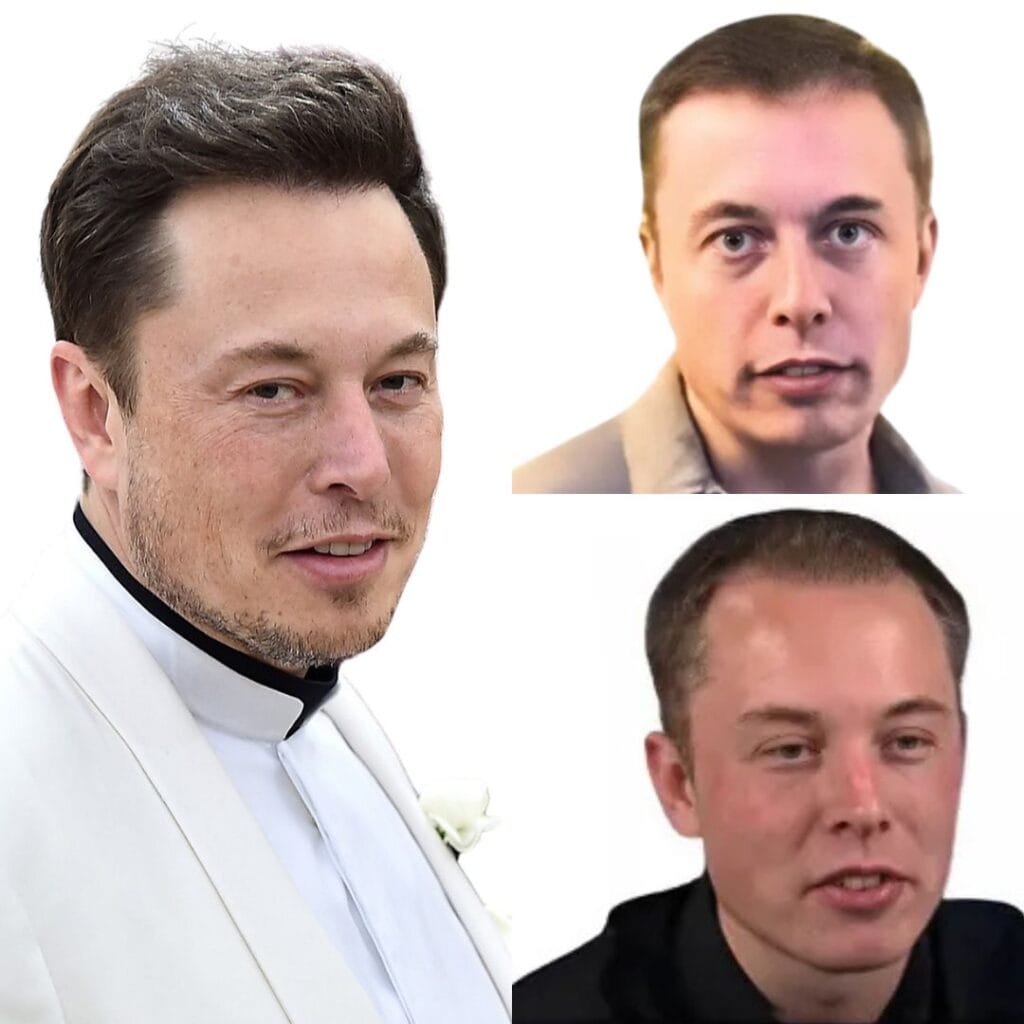 Elon Musk's public appearance after hair transplant.