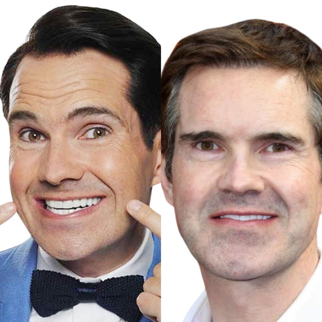 How did Jimmy Carr describe his hair transplant experience?