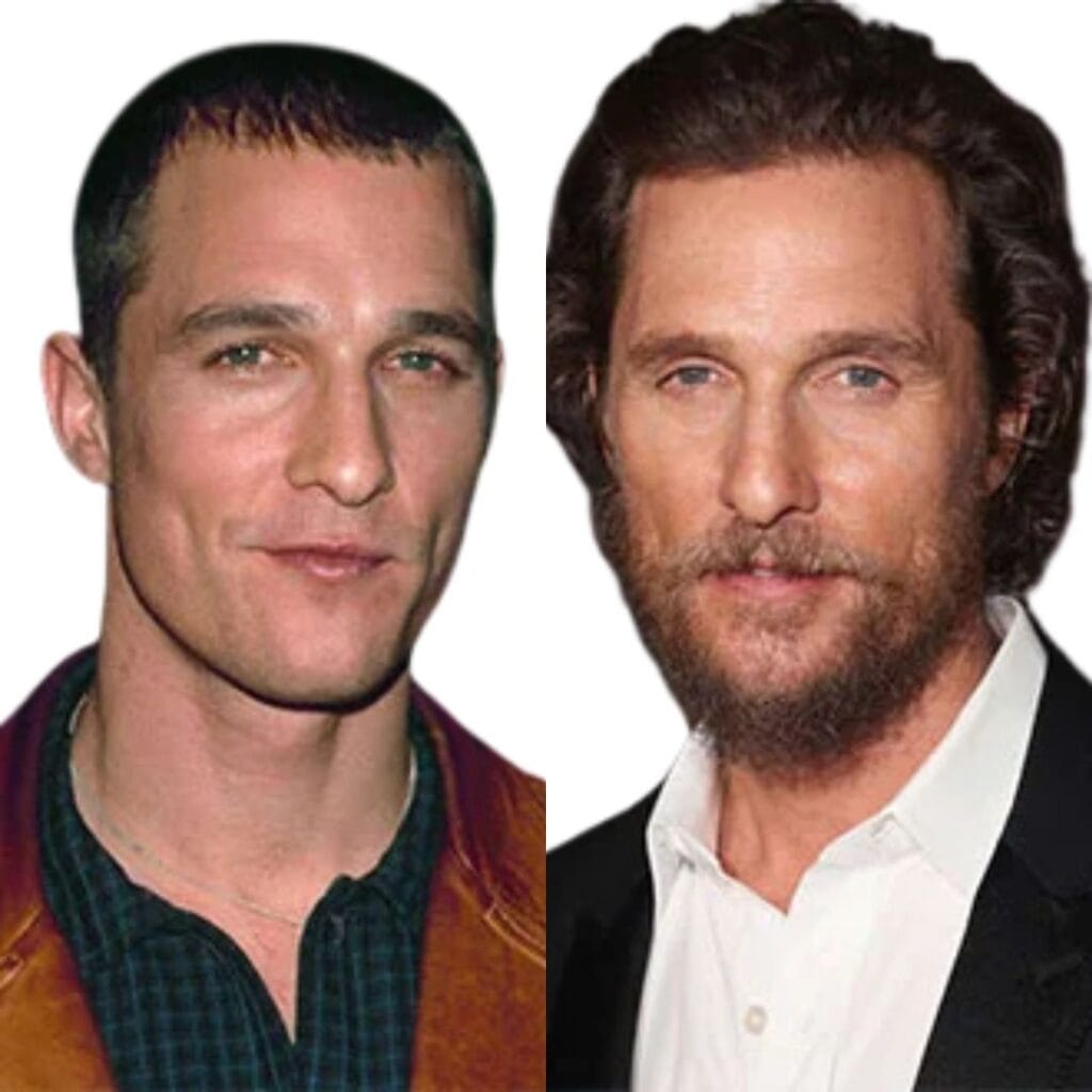 Matthew McConaughey's hairline improvement after rumored hair transplant