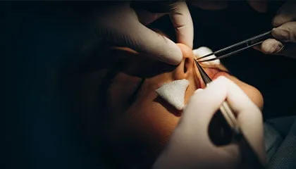 Recupero post-rinoplastica in Turchia con assistenza post-operatoria presso la Vivid Clinic.