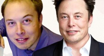 El proceso de trasplante de pelo por el que pasó Elon Musk