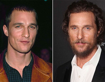 Matthew McConaughey's hairline improvement after rumored hair transplant