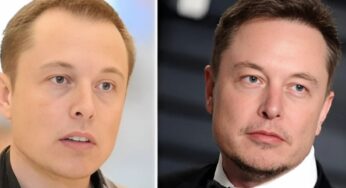 How Much Did Elon Musk’s Hair Transplant Cost? A Breakdown of Celebrity Hair Restoration