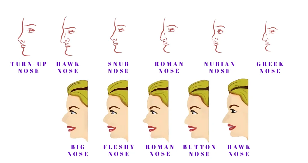 Side-by-side comparison type of nose between a Roman nose with a pronounced bridge and a small, rounded Button nose.