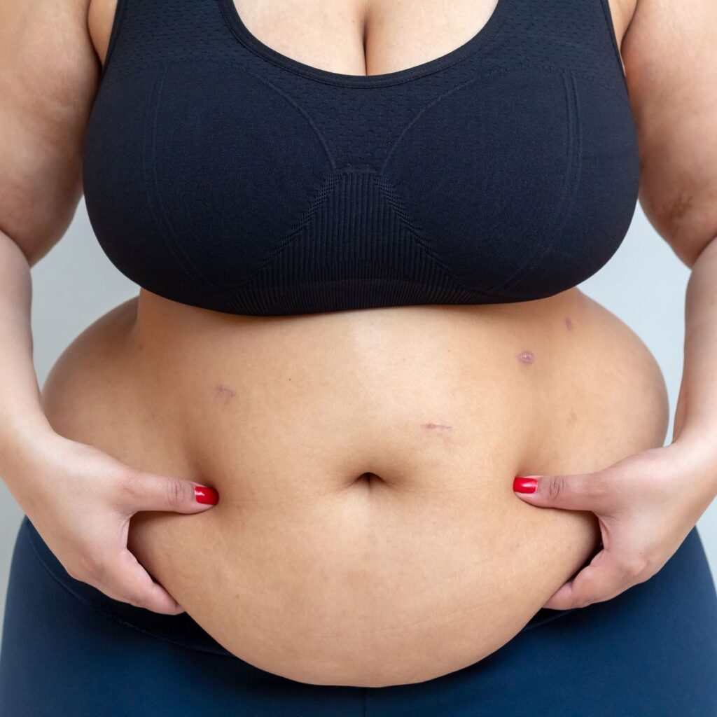 Hanging Belly After a C-Section: 7 Proven Ways to Tighten & Tone Your Tummy Hanging Belly After a C-Section: 7 Proven Ways to Tighten & Tone Your Tummy