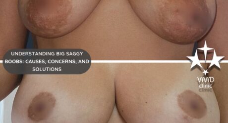 Big Saggy Boobs? Here’s How to Lift, Shape, and Regain Confidence!