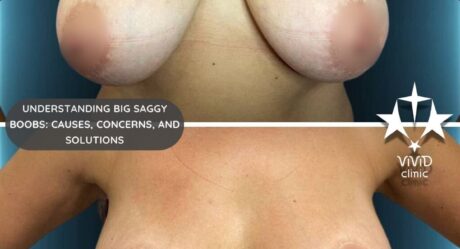 Big Saggy Boobs? 7 Proven Ways to Lift & Firm Your Breasts Naturally & Surgically