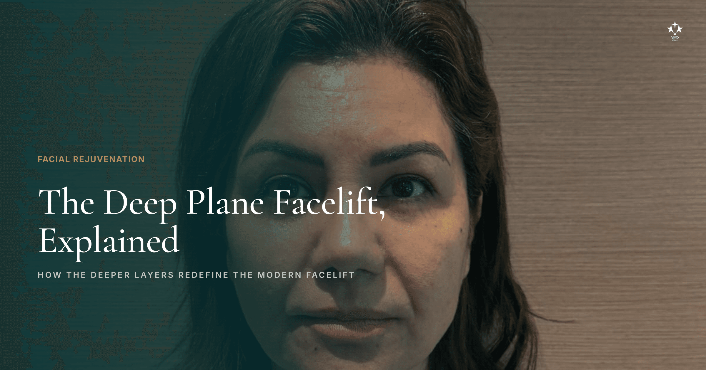 Deep Plane Facelift – patient results at Vivid Clinic Istanbul
