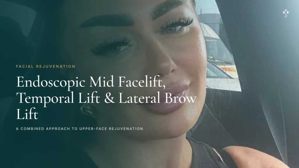 Vivid Clinic patient three months after endoscopic mid facelift with temporal and lateral brow lift, performed in Istanbul by Prof. Dr. Özgür Pilancı.