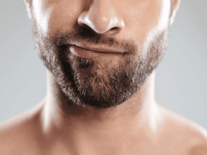 Baardtransplantatie in Turkije: 6 praktische tips vóór uw transformatie Voorbereiding op een consult voor een baardtransplantatie