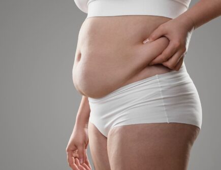 Hanging Belly After a C-Section: 7 Proven Ways to Tighten & Tone Your Tummy