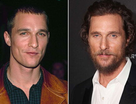 Matthew McConaughey's hairline improvement after rumored hair transplant