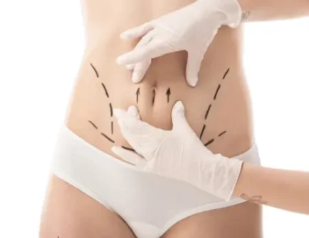 A patient thoughtfully considering the benefits of Liposuction at Vivid Clinic.